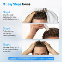 Rosemary Hair Growth Serum 25ml – PureBloom™