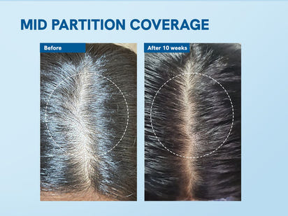 Rosemary Hair Growth Serum 25ml – PureBloom™