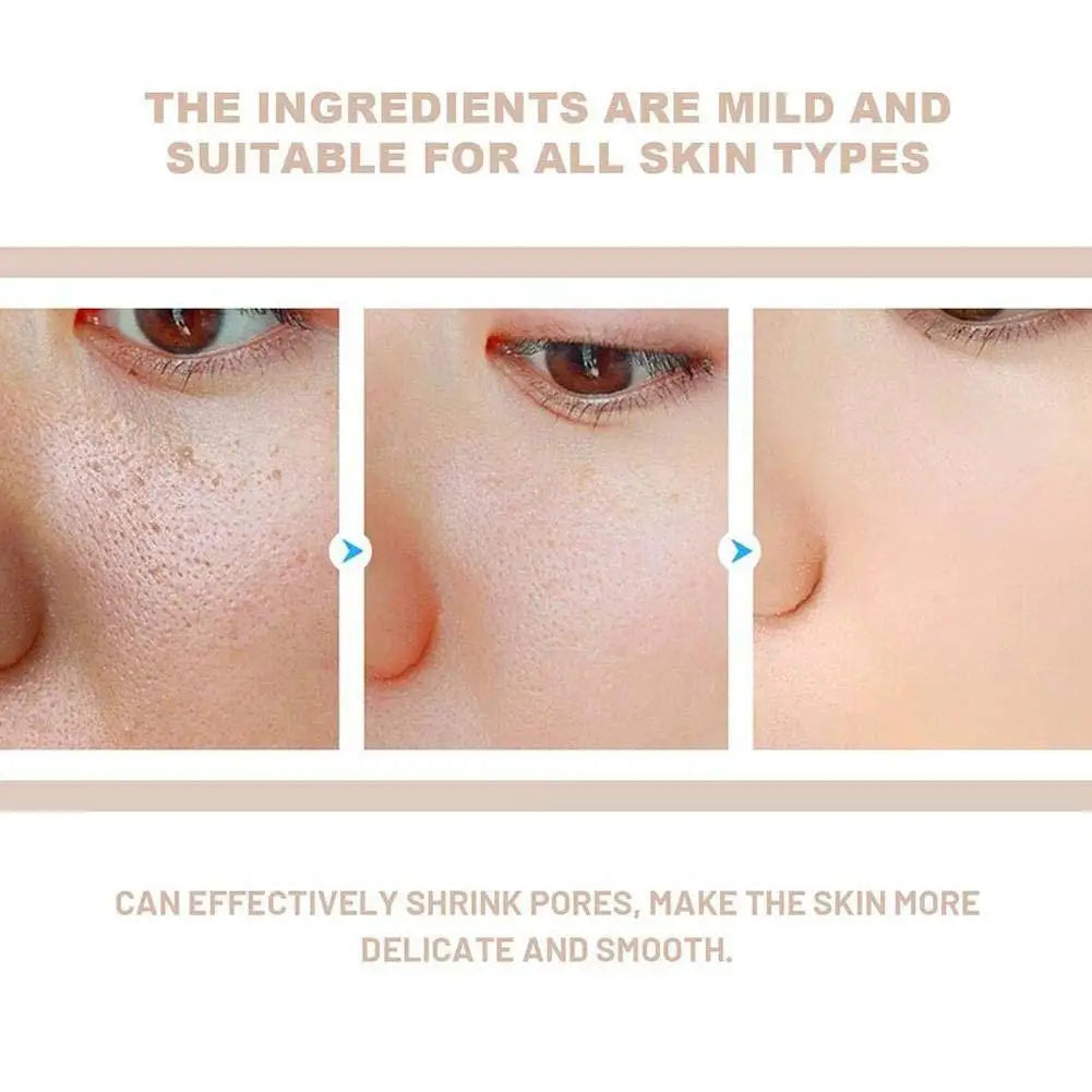 Black Rice Exfoliating Ampoule – Radiance Care & Deep Cleansing Dr. Mélaxine – PureBloom™