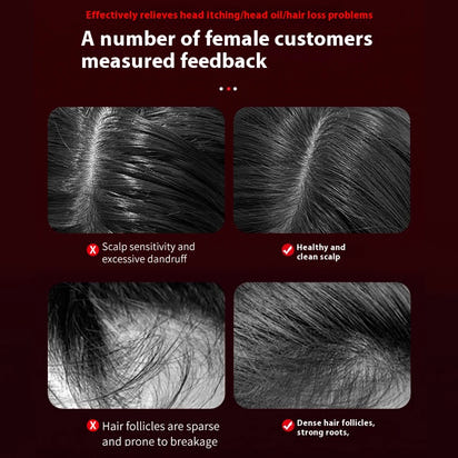 Peigne de Massage Infrarouge 630 nm – Stimule la Croissance & Apaise le Cuir Chevelu – PureBloom™