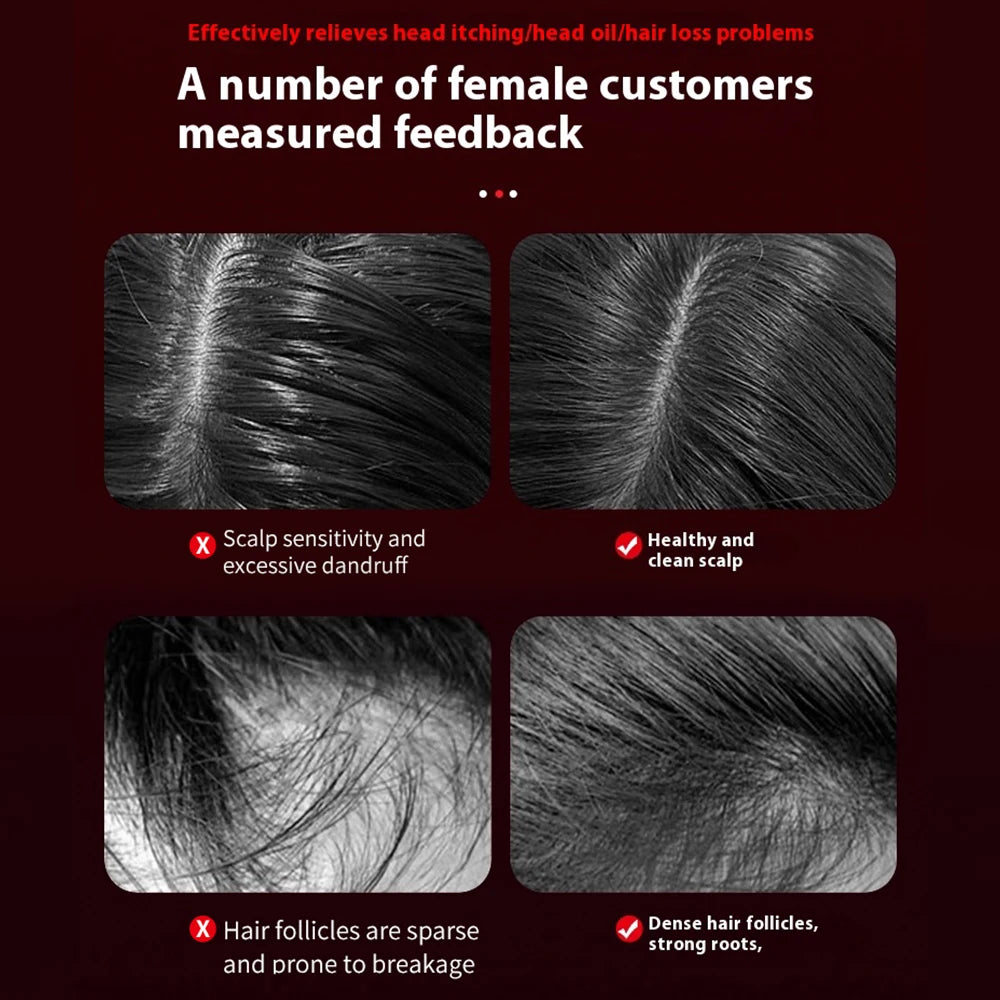 Peigne de Massage Infrarouge 630 nm – Stimule la Croissance & Apaise le Cuir Chevelu – PureBloom™