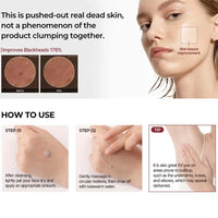 Black Rice Exfoliating Ampoule – Radiance Care & Deep Cleansing Dr. Mélaxine – PureBloom™