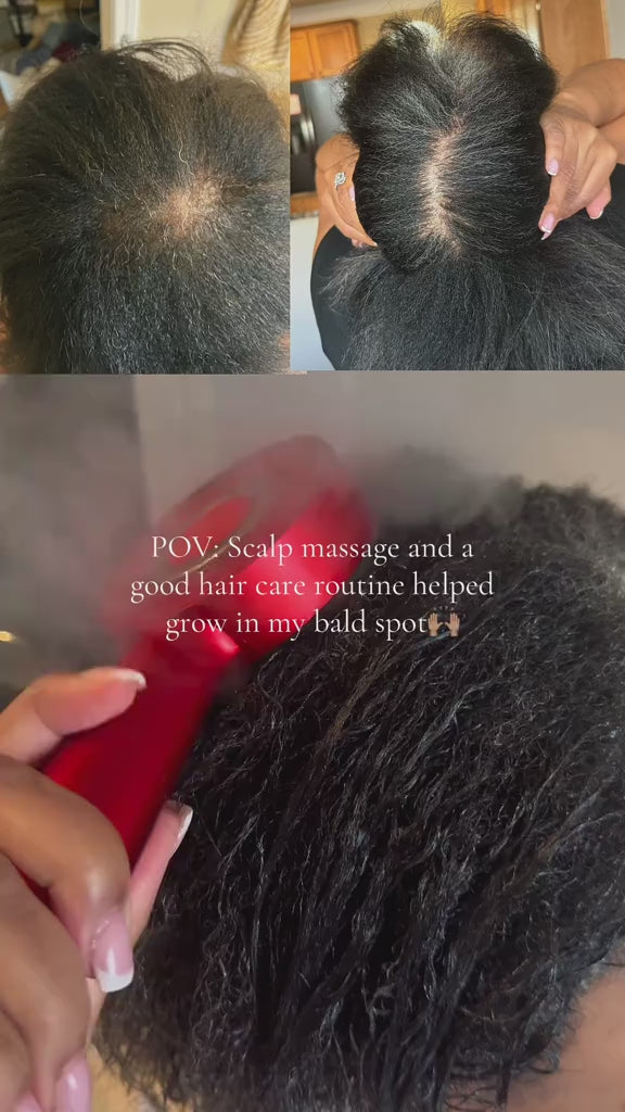 Peigne de Massage Infrarouge 630 nm – Stimule la Croissance & Apaise le Cuir Chevelu – PureBloom™ video