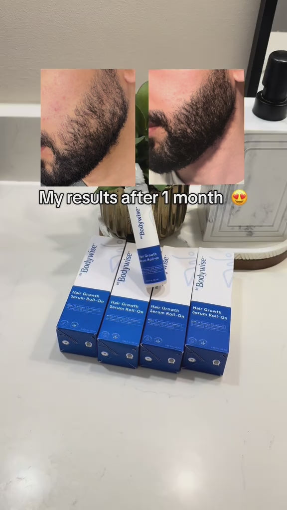 Rosemary Hair Growth Serum 25ml – PureBloom™ video