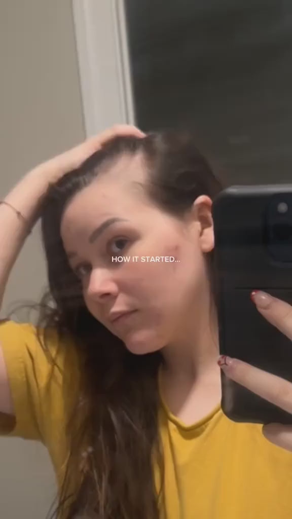 Rosemary Hair Growth Serum 25ml – PureBloom™ video