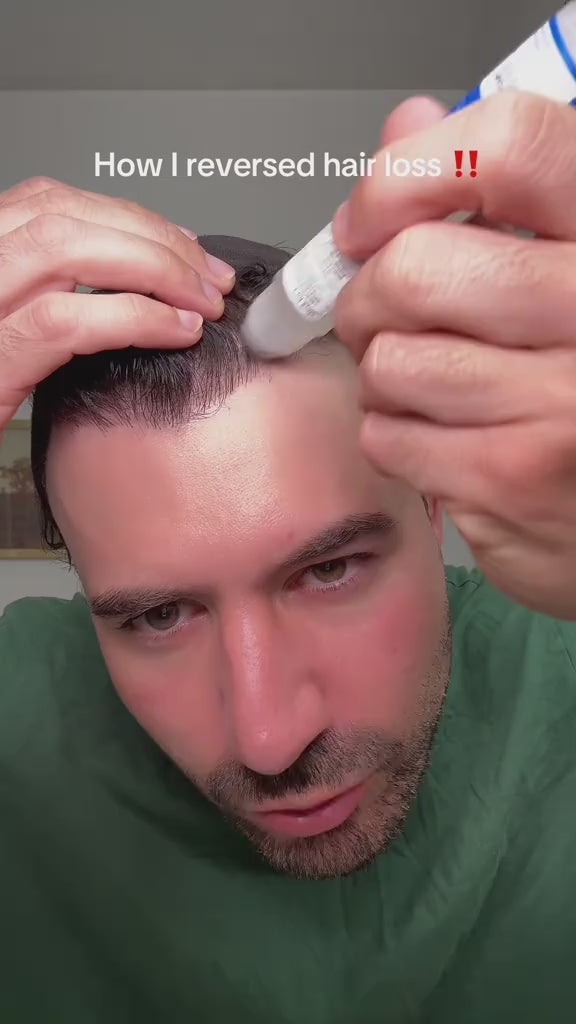 Rosemary Hair Growth Serum 25ml – PureBloom™ video